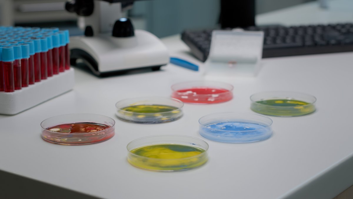 Petri dish with a bacterial culture