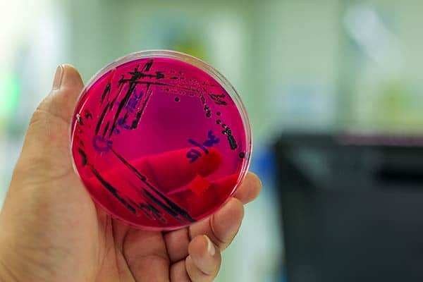 Legionellen-bekämpfen-Bakterien auf Petrischale